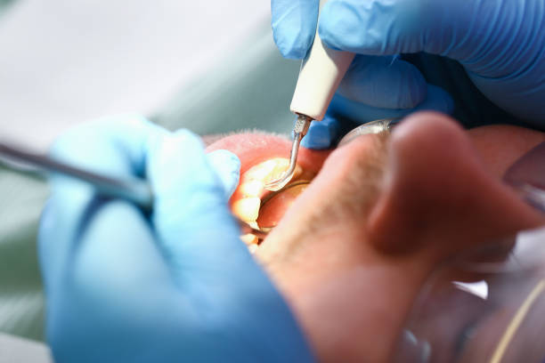 Best Emergency Gum Treatment in Clinton, SC