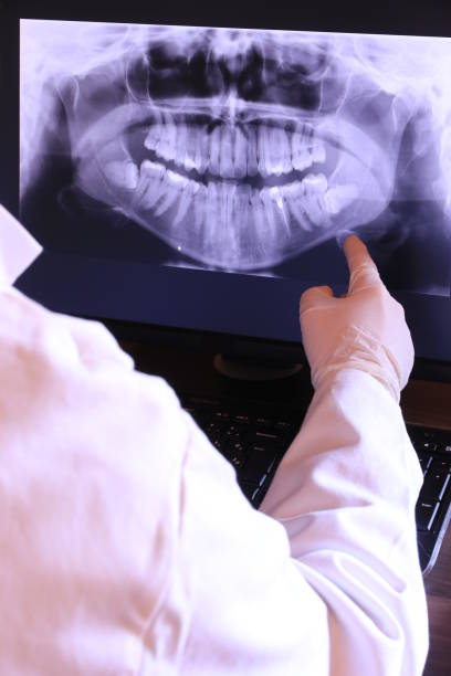 Best Emergency TMJ Treatment in Clinton, SC