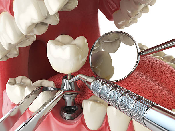 Trusted SC Emergency Dentist Experts